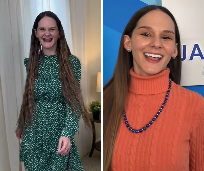 53 Dental Work That Made People Smile Without Hesitation And Shame 53 Dental Work That Made People Smile Without Hesitation And Shame