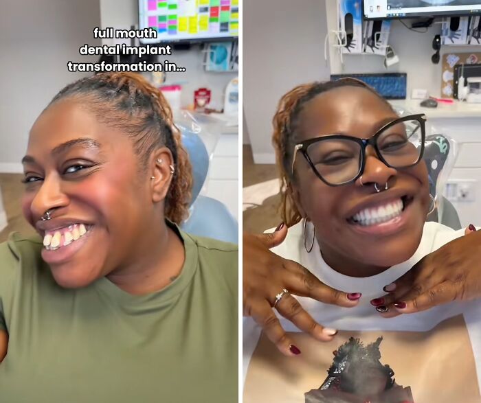 53 Dental Work That Made People Smile Without Hesitation And Shame 53 Dental Work That Made People Smile Without Hesitation And Shame