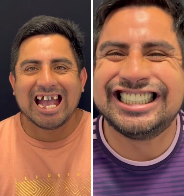 53 Dental Work That Made People Smile Without Hesitation And Shame 53 Dental Work That Made People Smile Without Hesitation And Shame