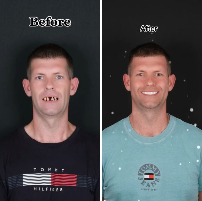 53 Dental Work That Made People Smile Without Hesitation And Shame 53 Dental Work That Made People Smile Without Hesitation And Shame