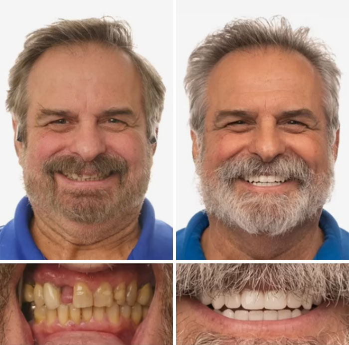 53 Dental Work That Made People Smile Without Hesitation And Shame 53 Dental Work That Made People Smile Without Hesitation And Shame