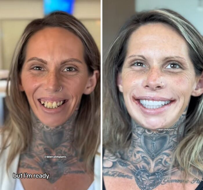 53 Dental Work That Made People Smile Without Hesitation And Shame 53 Dental Work That Made People Smile Without Hesitation And Shame