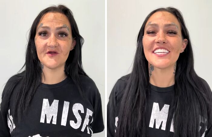 53 Dental Work That Made People Smile Without Hesitation And Shame 53 Dental Work That Made People Smile Without Hesitation And Shame