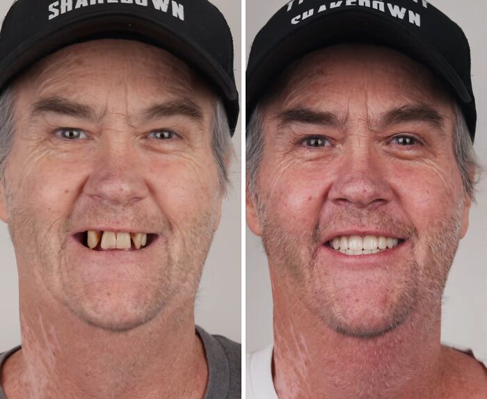 53 Dental Work That Made People Smile Without Hesitation And Shame 53 Dental Work That Made People Smile Without Hesitation And Shame