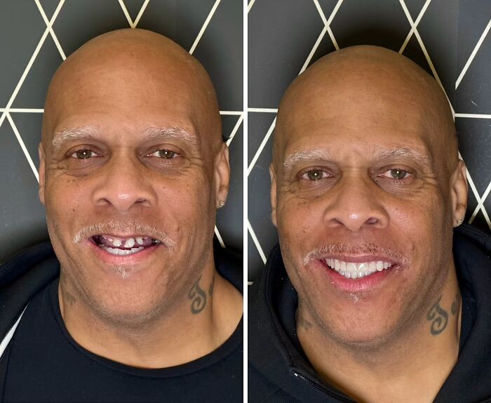53 Dental Work That Made People Smile Without Hesitation And Shame 53 Dental Work That Made People Smile Without Hesitation And Shame