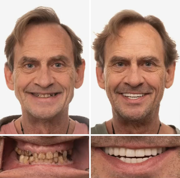 53 Dental Work That Made People Smile Without Hesitation And Shame 53 Dental Work That Made People Smile Without Hesitation And Shame