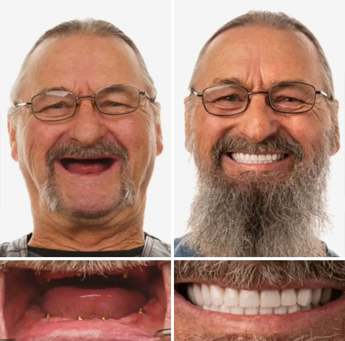 53 Dental Work That Made People Smile Without Hesitation And Shame 53 Dental Work That Made People Smile Without Hesitation And Shame