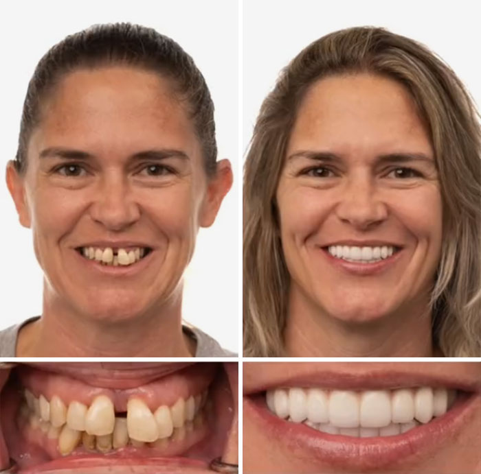 53 Dental Work That Made People Smile Without Hesitation And Shame 53 Dental Work That Made People Smile Without Hesitation And Shame