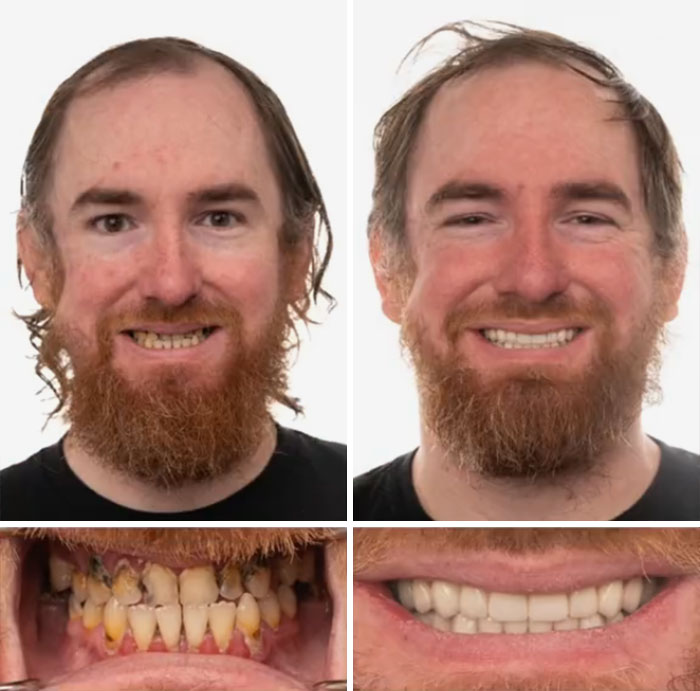 53 Dental Work That Made People Smile Without Hesitation And Shame 53 Dental Work That Made People Smile Without Hesitation And Shame