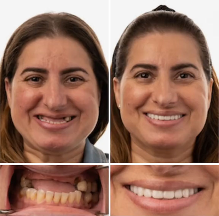 53 Dental Work That Made People Smile Without Hesitation And Shame 53 Dental Work That Made People Smile Without Hesitation And Shame
