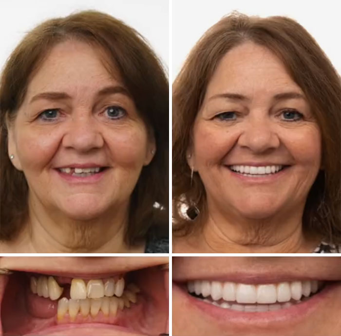 53 Dental Work That Made People Smile Without Hesitation And Shame 53 Dental Work That Made People Smile Without Hesitation And Shame