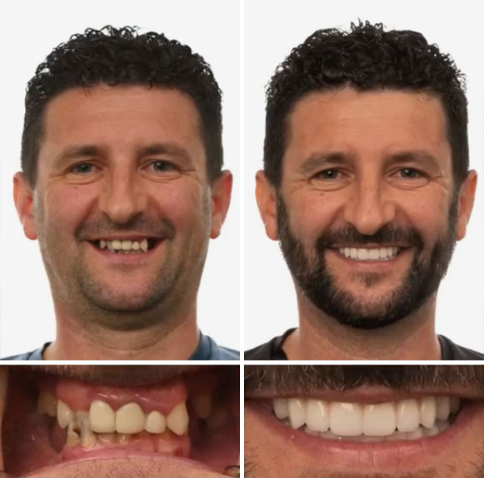 53 Dental Work That Made People Smile Without Hesitation And Shame 53 Dental Work That Made People Smile Without Hesitation And Shame