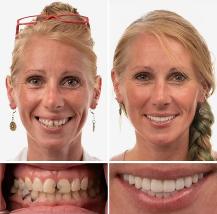 53 Dental Work That Made People Smile Without Hesitation And Shame 53 Dental Work That Made People Smile Without Hesitation And Shame