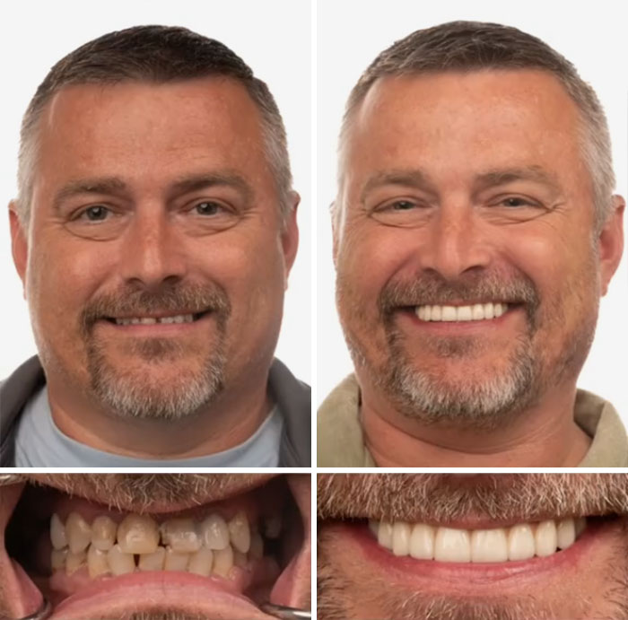 53 Dental Work That Made People Smile Without Hesitation And Shame 53 Dental Work That Made People Smile Without Hesitation And Shame