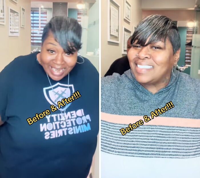 53 Dental Work That Made People Smile Without Hesitation And Shame 53 Dental Work That Made People Smile Without Hesitation And Shame