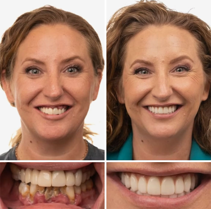 53 Dental Work That Made People Smile Without Hesitation And Shame 53 Dental Work That Made People Smile Without Hesitation And Shame