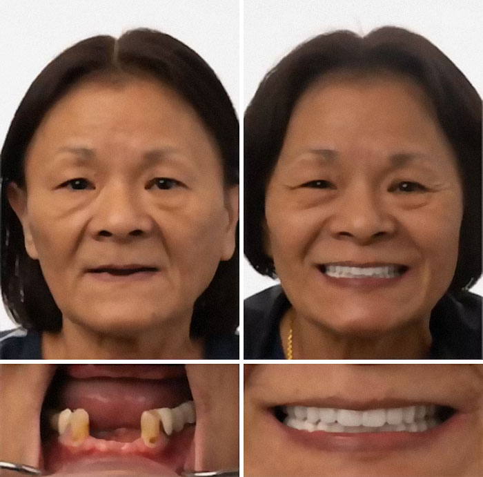 53 Dental Work That Made People Smile Without Hesitation And Shame 53 Dental Work That Made People Smile Without Hesitation And Shame