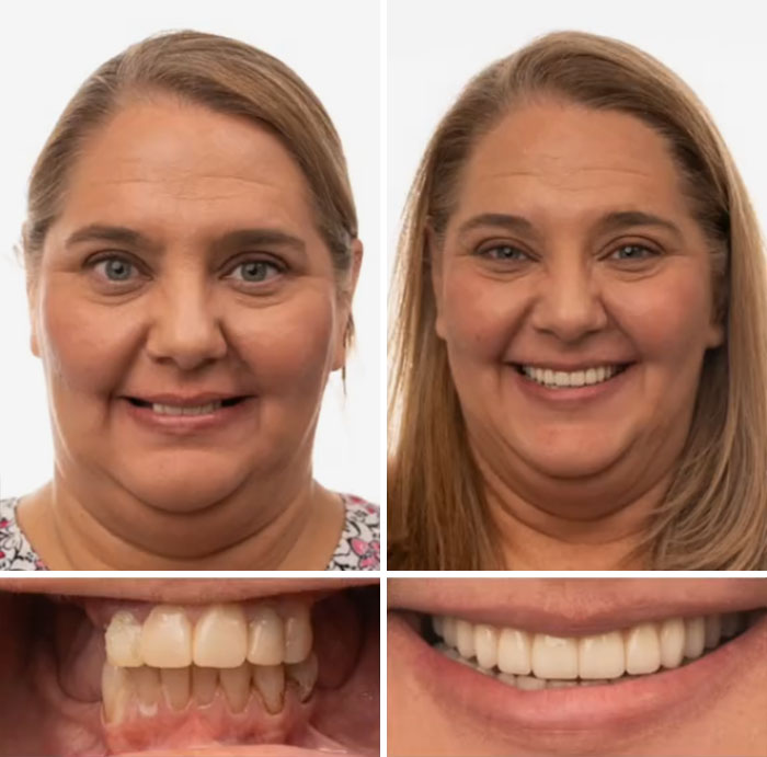 53 Dental Work That Made People Smile Without Hesitation And Shame 53 Dental Work That Made People Smile Without Hesitation And Shame