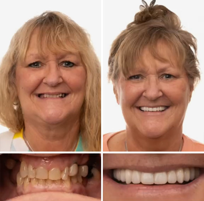 53 Dental Work That Made People Smile Without Hesitation And Shame 53 Dental Work That Made People Smile Without Hesitation And Shame
