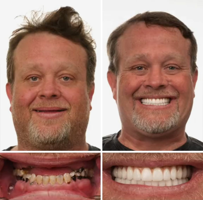 53 Dental Work That Made People Smile Without Hesitation And Shame 53 Dental Work That Made People Smile Without Hesitation And Shame