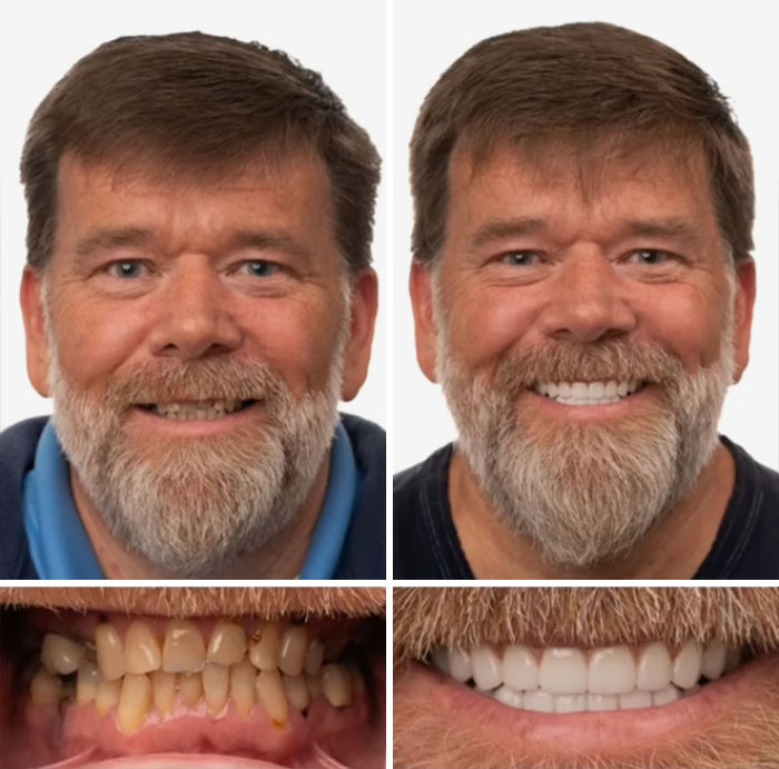 53 Dental Work That Made People Smile Without Hesitation And Shame 53 Dental Work That Made People Smile Without Hesitation And Shame