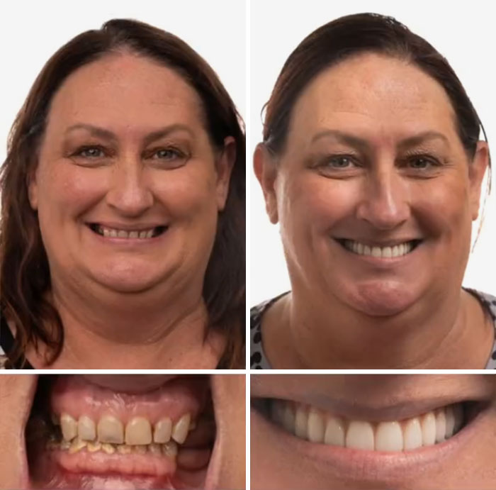53 Dental Work That Made People Smile Without Hesitation And Shame 53 Dental Work That Made People Smile Without Hesitation And Shame