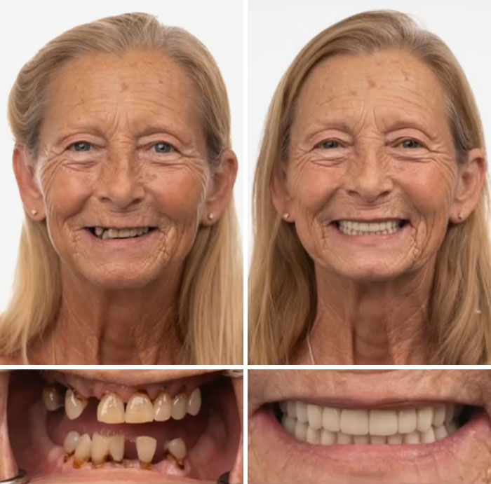 53 Dental Work That Made People Smile Without Hesitation And Shame 53 Dental Work That Made People Smile Without Hesitation And Shame