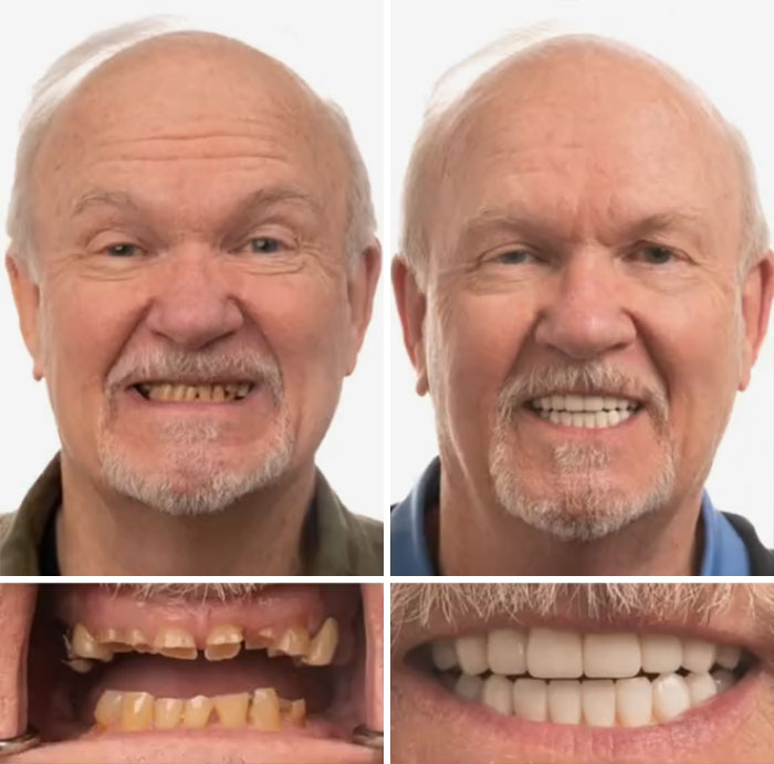53 Dental Work That Made People Smile Without Hesitation And Shame 53 Dental Work That Made People Smile Without Hesitation And Shame