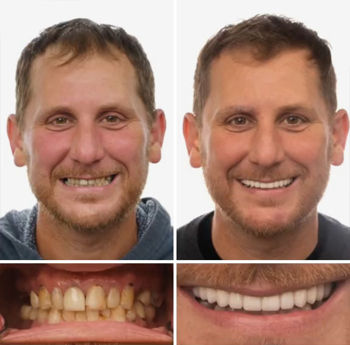 53 Dental Work That Made People Smile Without Hesitation And Shame 53 Dental Work That Made People Smile Without Hesitation And Shame