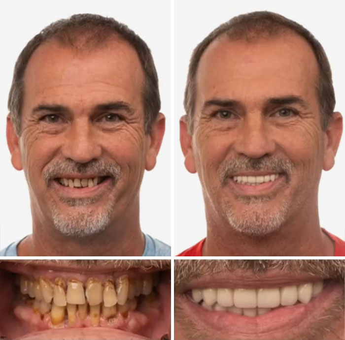 53 Dental Work That Made People Smile Without Hesitation And Shame 53 Dental Work That Made People Smile Without Hesitation And Shame