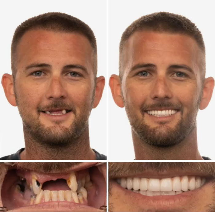 53 Dental Work That Made People Smile Without Hesitation And Shame 53 Dental Work That Made People Smile Without Hesitation And Shame