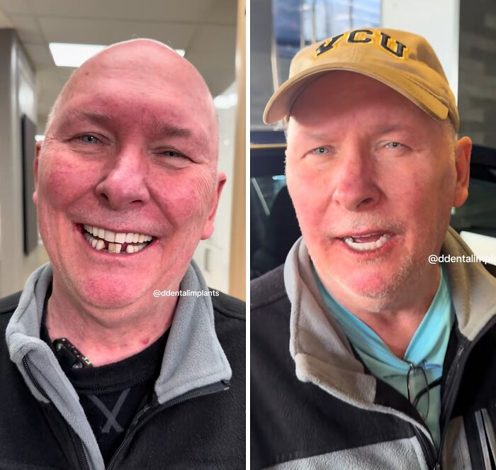 53 Dental Work That Made People Smile Without Hesitation And Shame 53 Dental Work That Made People Smile Without Hesitation And Shame