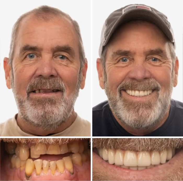 53 Dental Work That Made People Smile Without Hesitation And Shame 53 Dental Work That Made People Smile Without Hesitation And Shame