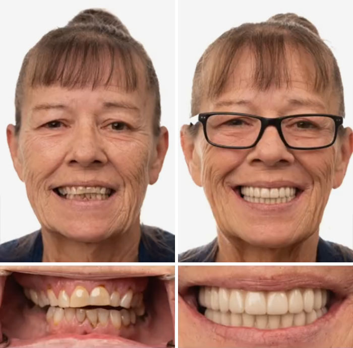 53 Dental Work That Made People Smile Without Hesitation And Shame 53 Dental Work That Made People Smile Without Hesitation And Shame