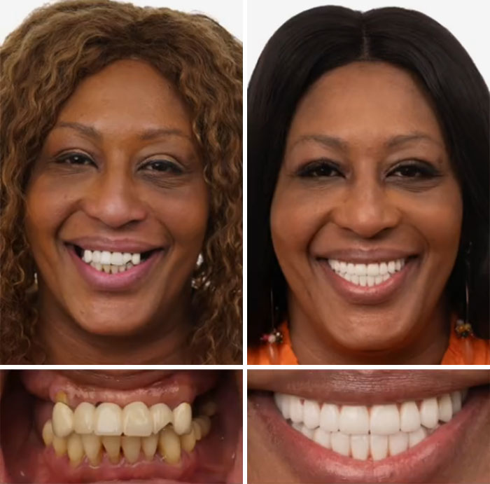 53 Dental Work That Made People Smile Without Hesitation And Shame 53 Dental Work That Made People Smile Without Hesitation And Shame