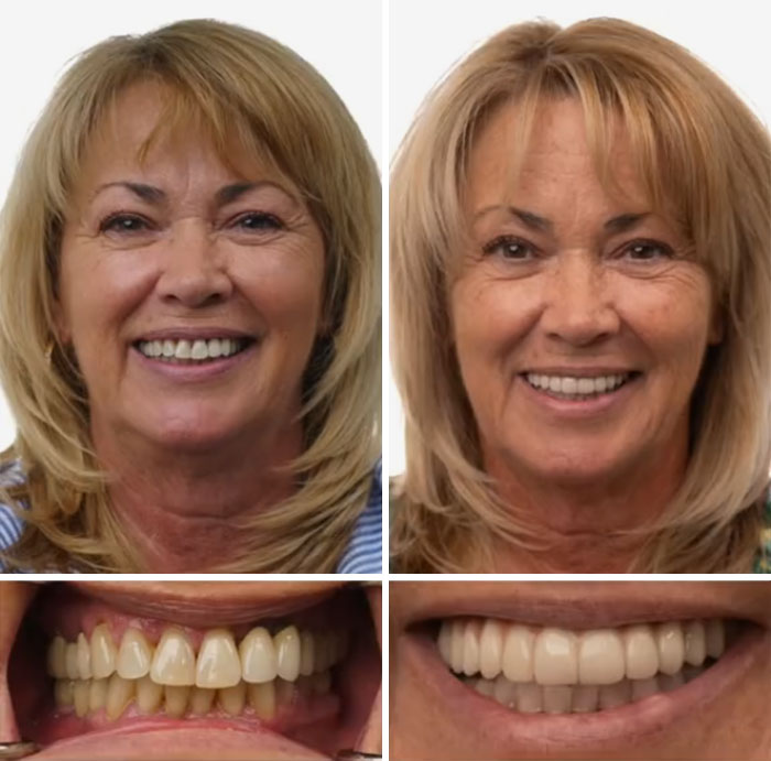 53 Dental Work That Made People Smile Without Hesitation And Shame 53 Dental Work That Made People Smile Without Hesitation And Shame