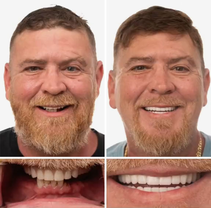 53 Dental Work That Made People Smile Without Hesitation And Shame 53 Dental Work That Made People Smile Without Hesitation And Shame