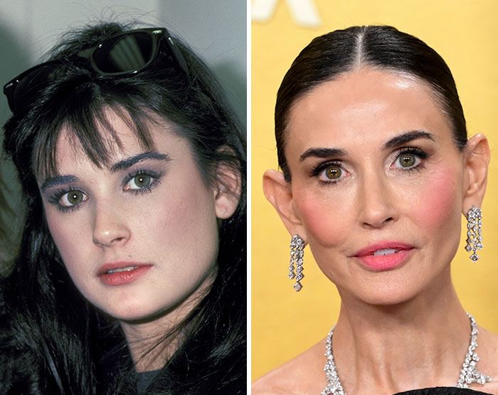 “Is This The Latest Beauty Standard?”: Demi Moore’s Red Carpet Transformation Sparks Debate