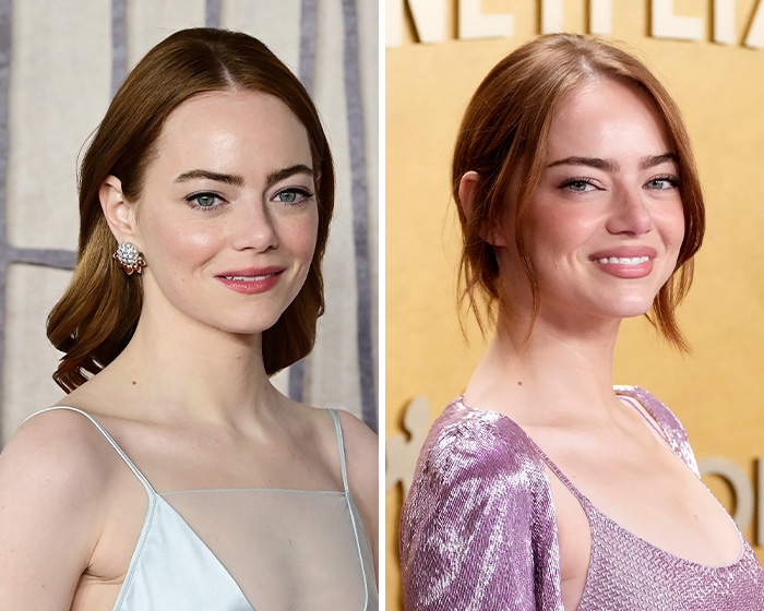 Emma Stone&rsquo;s Unexpected Appearance At The 2026 Actor Awards Has Fans Talking