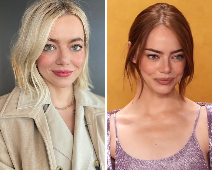 Emma Stone&rsquo;s Unexpected Appearance At The 2026 Actor Awards Has Fans Talking
