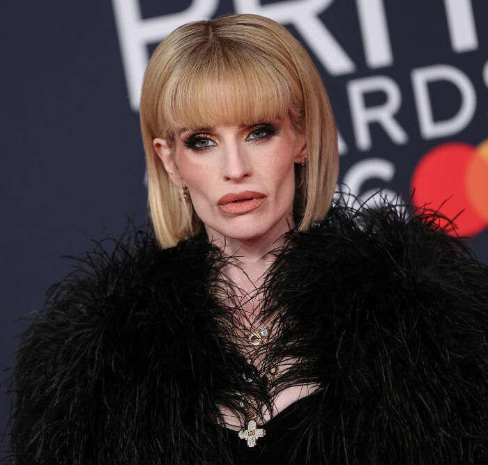 “Dealing With A Lot”: How Kelly Osbourne’s Friends Are Reacting To Her Dramatic Weight Loss “Dealing With A Lot”: How Kelly Osbourne’s Friends Are Reacting To Her Dramatic Weight Loss