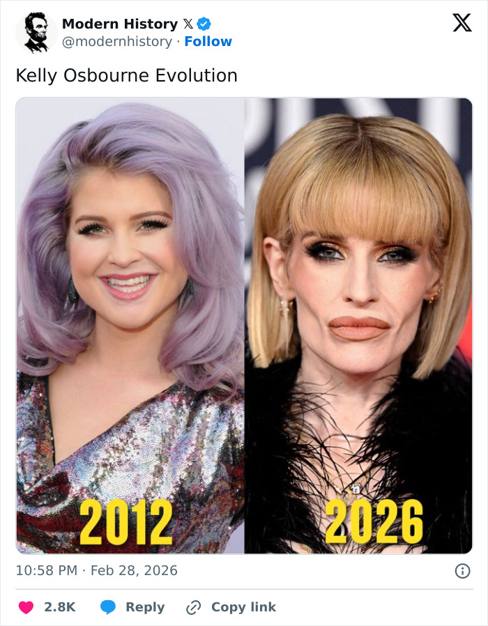 “Dealing With A Lot”: How Kelly Osbourne’s Friends Are Reacting To Her Dramatic Weight Loss “Dealing With A Lot”: How Kelly Osbourne’s Friends Are Reacting To Her Dramatic Weight Loss