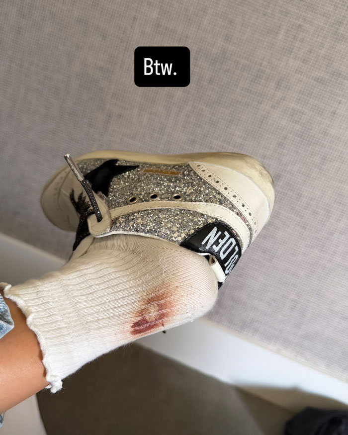 JoJo Siwa Reveals Painful Aftermath Of Wedding After Walking Down The Aisle With Chris Hughes