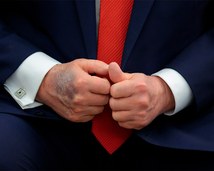 Doctors Weigh In On Trump’s Neck Rash, Suggesting Likely Cause Amid White House’s ‘Preventative Treatment’ Claim Doctors Weigh In On Trump’s Neck Rash, Suggesting Likely Cause Amid White House’s ‘Preventative Treatment’ Claim