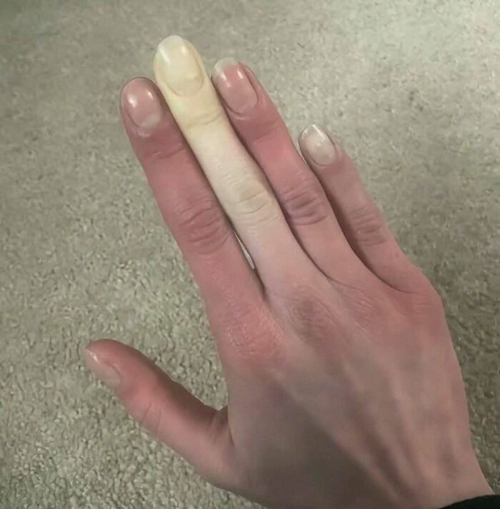 &ldquo;Green Hairy Tongue!&rdquo;: These 41 Medical Images That Should Be Viewed With Caution (New Pics)