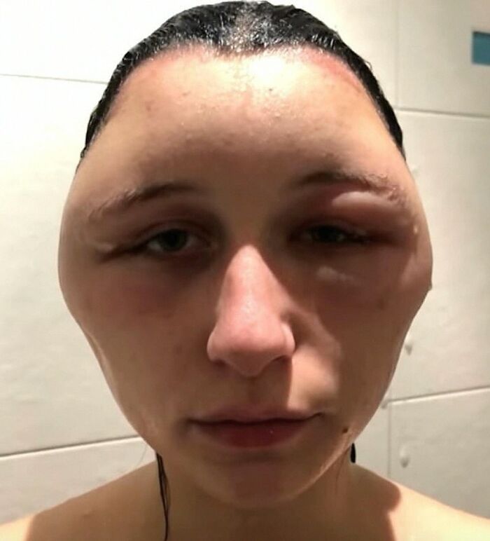 &ldquo;Green Hairy Tongue!&rdquo;: These 41 Medical Images That Should Be Viewed With Caution (New Pics)