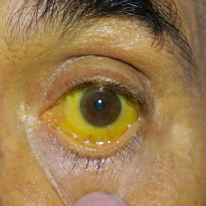 &ldquo;Green Hairy Tongue!&rdquo;: These 41 Medical Images That Should Be Viewed With Caution (New Pics)