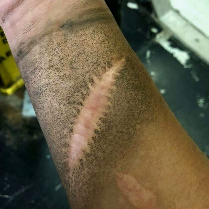 &ldquo;Green Hairy Tongue!&rdquo;: These 41 Medical Images That Should Be Viewed With Caution (New Pics)