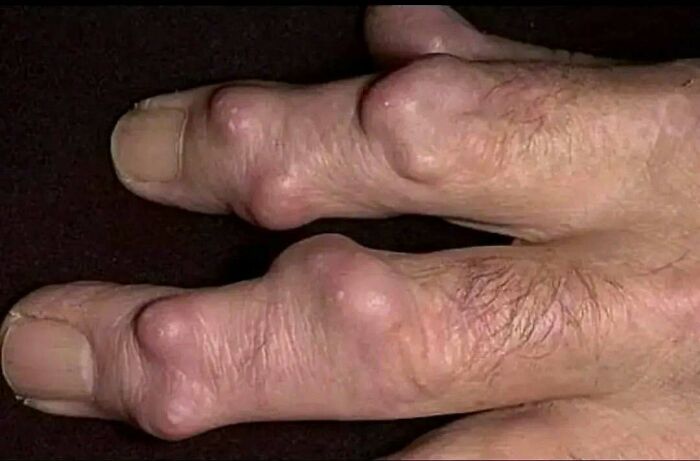 &ldquo;Green Hairy Tongue!&rdquo;: These 41 Medical Images That Should Be Viewed With Caution (New Pics)