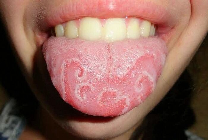 &ldquo;Green Hairy Tongue!&rdquo;: These 41 Medical Images That Should Be Viewed With Caution (New Pics)